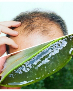 3 Best Cure For Male Baldness