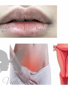 Quick health tips: 3 turn-dark body areas early detect unhealthy uterus