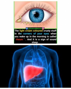 Frequently appearing rheum might be a sign of unhealthy liver