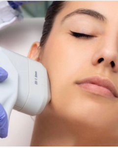 HIFU FACIAL TREATMENT: 10 THINGS TO KNOW