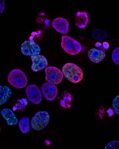 Israel Develops Method to Make Cancer Cells \'Commit Suicide\'